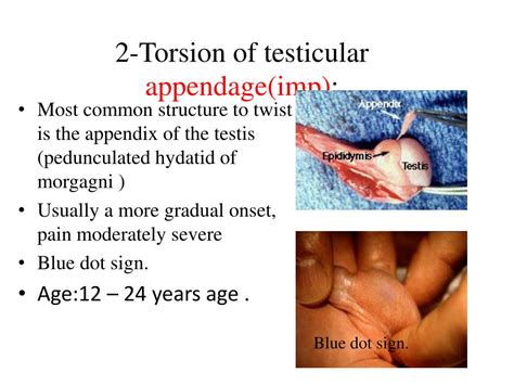 appendicel torsion testes|blue dot sign appendix testis.